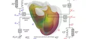 Cardiac Surgery: Simulation for a better prediction 